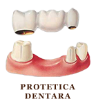 Protetica dentara