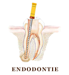 Endodontie